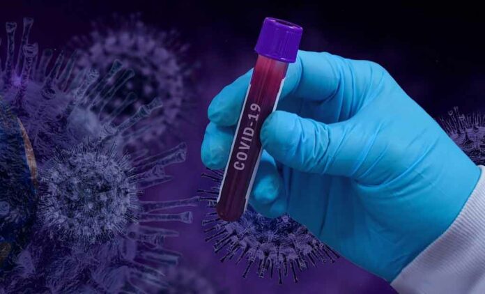 The blood plasma of 38 patients tested positive for SARS-CoV-2, three tested negative, and plasma was unavailable for the other three.