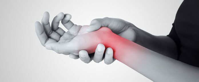 Understanding Carpal Tunnel Syndrome: Relief, Treatment, and Prevention